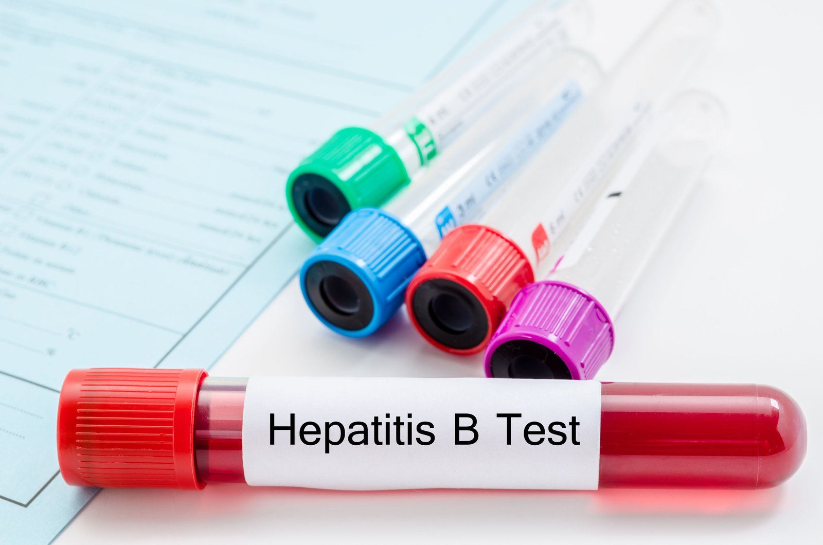 Do You Need a Doctor’s Prescription for Hepatitis B Testing?
